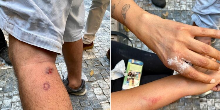 Gazetecilere polis şiddetine TGC’den kınama